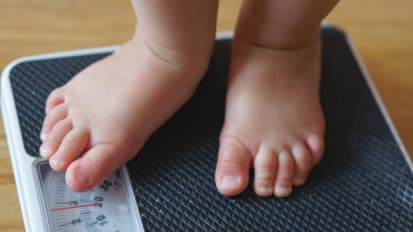 Overcoming Obesity in Childhood: New Advice and Treatment Options