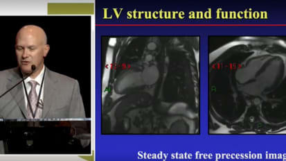 State of the Art Cardiovascular Imaging