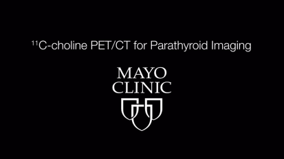 <sup>11</sup>C-choline PET/CT for parathyroid imaging