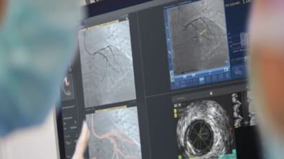 Live case broadcast: Optimizing coronary stenting with IVUS guidance