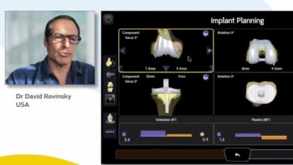 Achieving Anatomical Alignment With Handheld Robotics and JOURNEY™ II TKA System