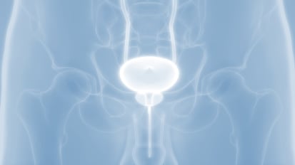 What is the Same and What Has Changed with the Artificial Urinary Sphincter? 