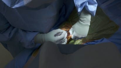 Robotic-assisted TKA with Dr. Jamie Hernandez- Case 2