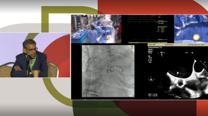 Live Case: Percutaneous Mitral Valve