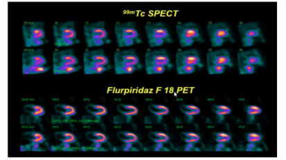 17th Annual Virani Lectureship: Cardiac PET in 2018