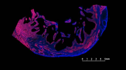 Unbreaking the Heart - Cardiac Remuscularization in Non-Human Primate Models