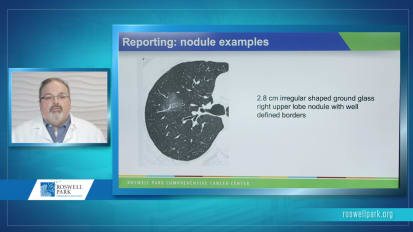 Practical Aspects of Lung Cancer Screening for the Radiologist