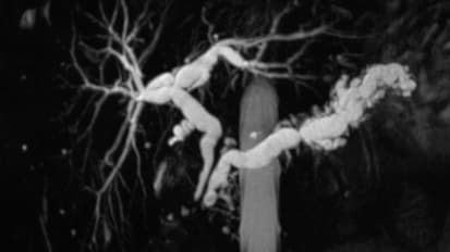 Chronic Pancreatitis