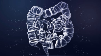 Young-Onset Colorectal Cancer Center Gut Instincts Series: Best Practices for Symptom Management