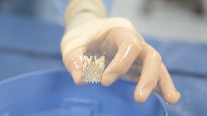 TAVR with Jenavalve Treats Severe Aortic Regurgitation and Stenosis