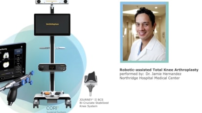 Robotic-Assisted Total Knee Arthroplasty Under 35 Minutes Using the CORI&trade; Surgical System 