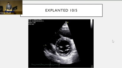 Myocardial Recovery in Cardiogenic Shock on Mechanical Support – Cellular Mechanisms