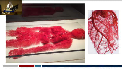 Targeting Microcirculation in Cardiogenic Shock on Temporary MCSS