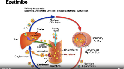 Updates in Lipids