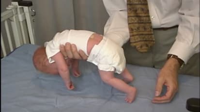 Muscle Weakness/Hypotonia for the General Pediatrician