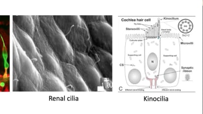 Updates on Primary Ciliary Dyskinesia Diagnosis