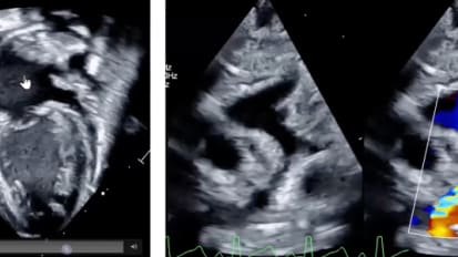 Pediatric Heart Failure: An Often Missed, Potentially Urgent Diagnosis