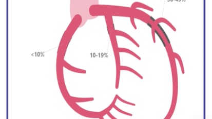 Residual Risk Assessment: Cardiologist Use of Cardiometabolic Drugs