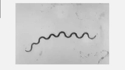 Congenital Syphilis: An Epidemic Driven by Social Determinants of Health
