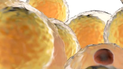Treating Cardiovascular Disease Through Weight Loss