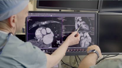 UCI Health places Watchman device with new innovative protocol 