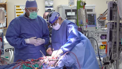 ViMAC-TMVR Via Open Atriotomy