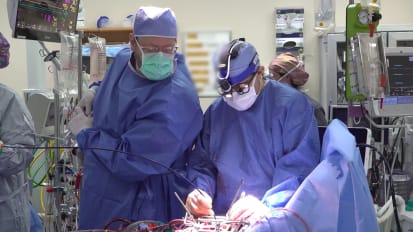 ViMAC-TMVR Via Open Atriotomy