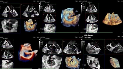 Current State of Transcatheter Mitral Valve Therapies: The Common, Complex and Current Research at the Sentara Heart Valve Center in 2026