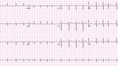 Cardiology in Motion: How Wearable Devices are Changing Patient Care