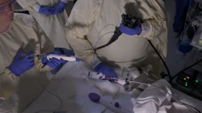 Ascending Colon HGD ESD Procedure with DiLumen C1 and IgE Grasper