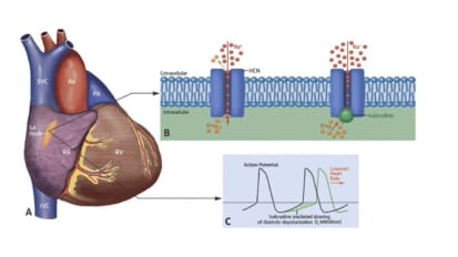 Heart Failure with Reduced Ejection Fraction: The Preeminent Role of Medical Management