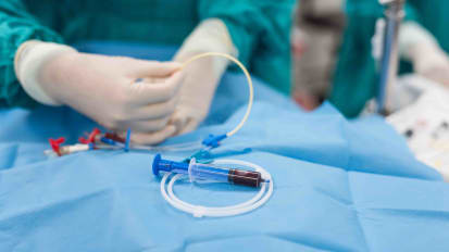 The Minimally Invasive Endovascular Approach