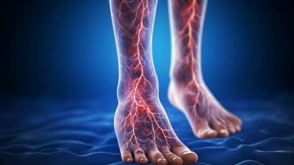 Lower Extremity Peripheral Vascular Disease – The Future of Vascular Care