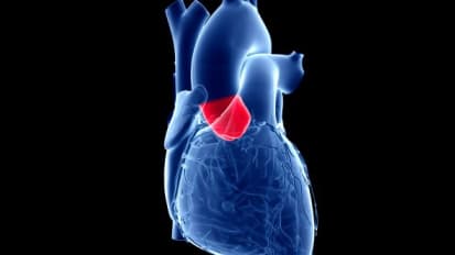 Recent Advances in Transcatheter Aortic Valve Replacement