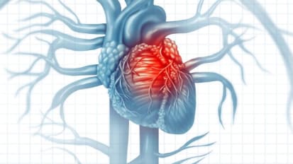 When Prosthetic Valves Fail: Why Hemodynamics Matter and How Structural Valve Degeneration is Managed