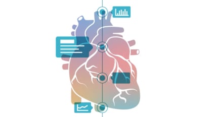 The Modern Cardiac Intensive Care Unit and the Genesis of Critical Care Cardiology