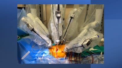 Minimally Invasive Cardiac Surgery