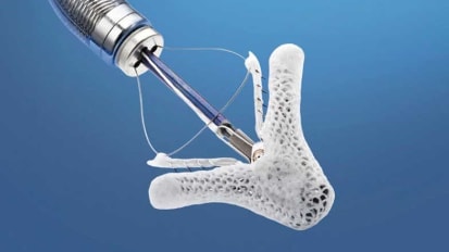 Sentara Master Series Presents a LIVE MitraClip Mitral Valve Repair