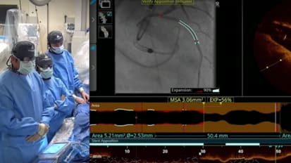 Live Case: Complex Coronary