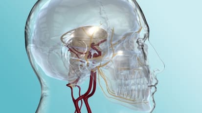 Trigeminal Neuralgia Symptoms and Treatment Options