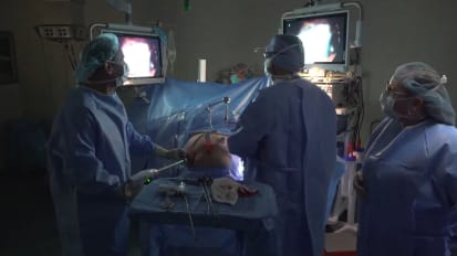 Sleeve Gastrectomy
