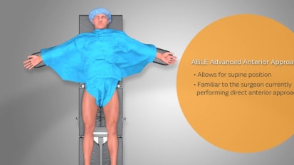 ABLE&trade; Advanced Anterior Approach- Anterior Position