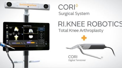 Animation: TKA Workflow with CORI™ System featuring the CORI™ Digital Tensioner