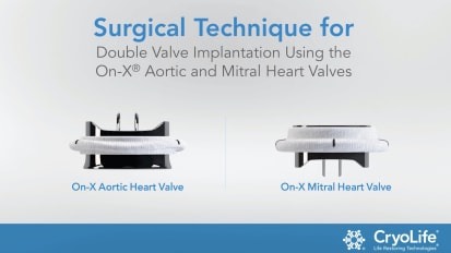 Surgical Technique for Double Valve Implantation Using the On-X® Aortic and Mitral Heart Valves