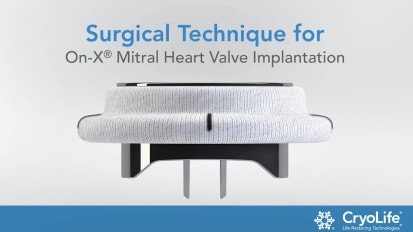Surgical Technique for On-X® Mitral Heart Valve Implantation
