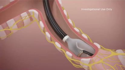 Targeted Lung Denervation