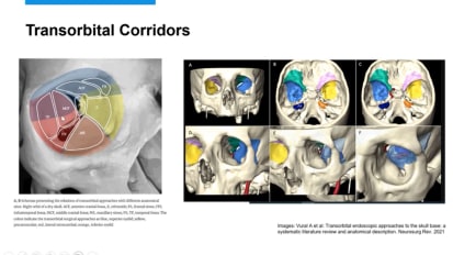 The Road Less Travelled: Transorbital Neurosurgical Approaches