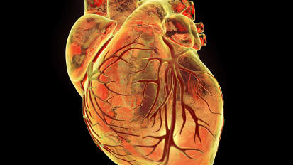 Percutaneous Treatment of Cardiac Valvular Disease: Part 2