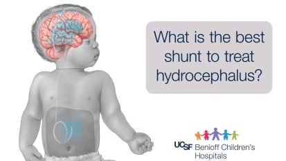 Hydrocephalus: The Workhorse Shunt