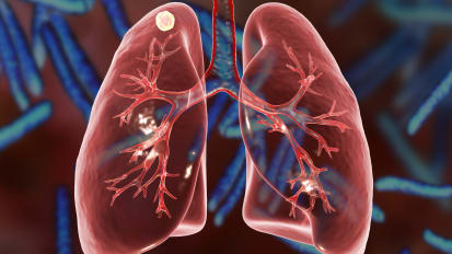 Better Management of Lung Nodules: Cutting-Edge Diagnostic and Therapeutic Tools